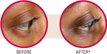 neuLash Before and After
