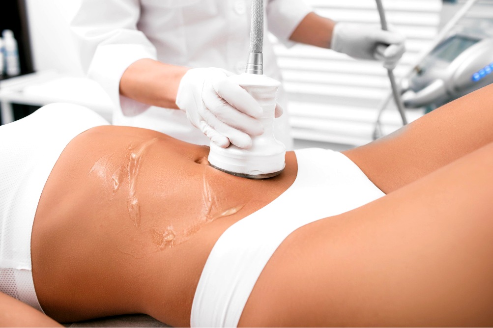 cavitation treatments training