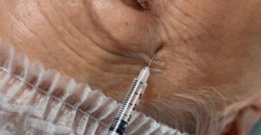 Neuramis Deep Lido – Filler Against Deep Wrinkles