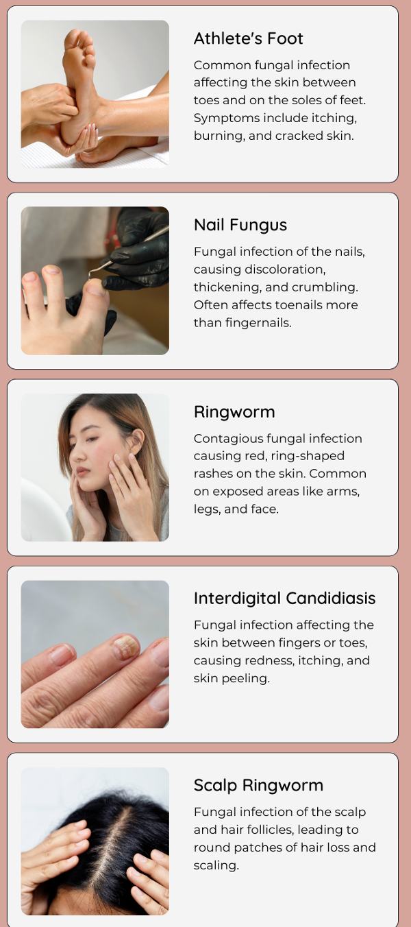 types of fungal infection